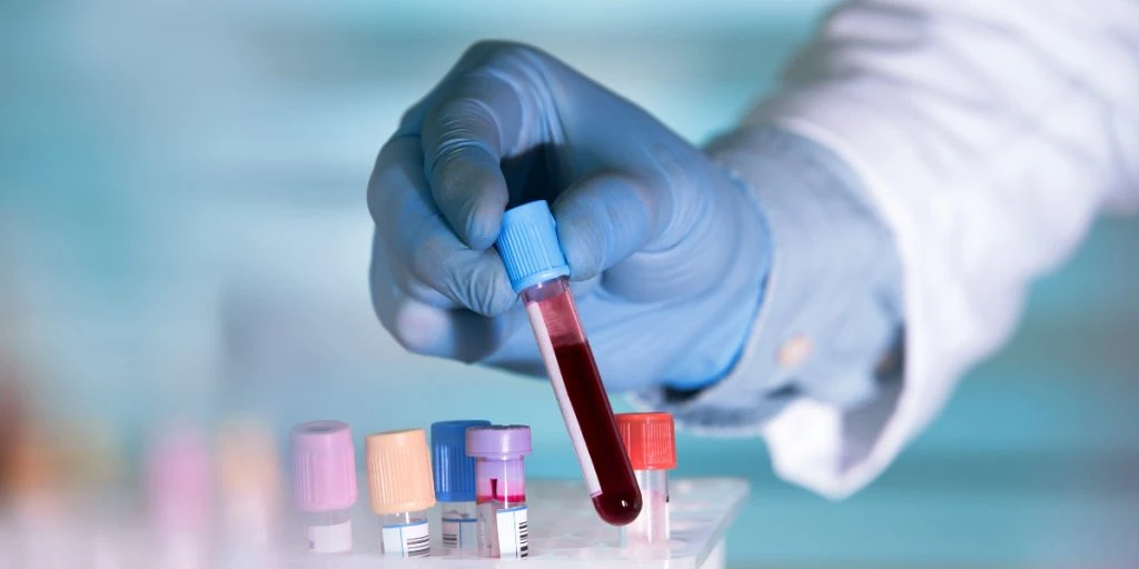 New Research Suggests Donating Blood May Reduce Risk of Certain Cancers