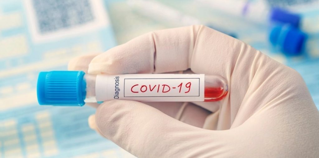 CIA Declassified Report Points to Possible Lab Leak as COVID-19 Origin