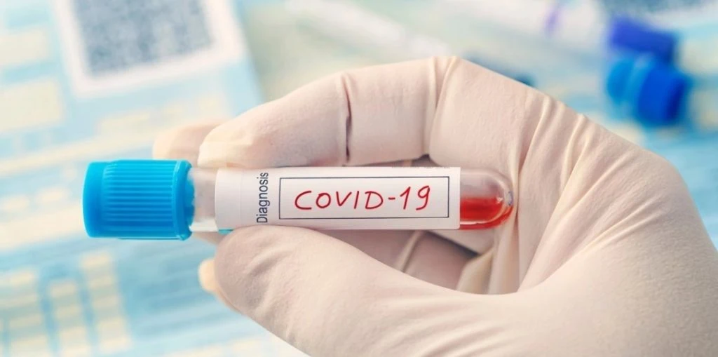 Key Cause of Long COVID Fatigue Revealed in New Study