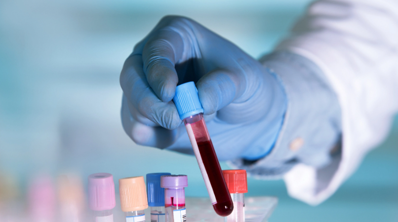 New Study: Modern Diseases Affected People Thousands of Years Ago