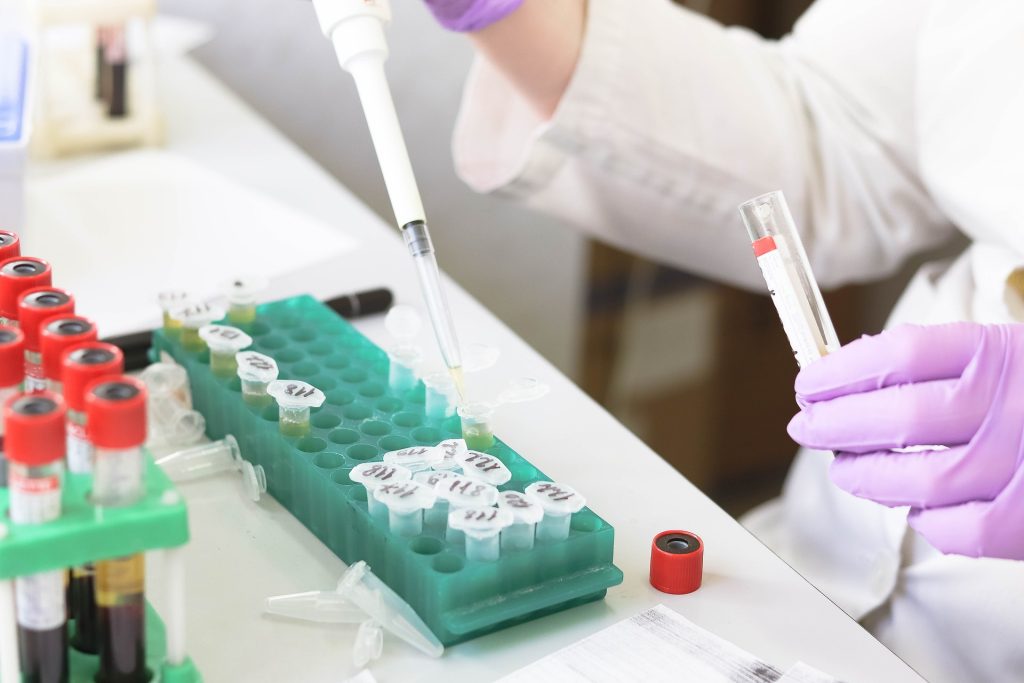 Scientists Find Bacteria in Asteroid Samples