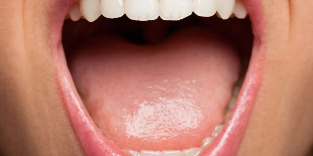 7 Signs of Diabetes That Appear in the Mouth and How to Detect the Disease