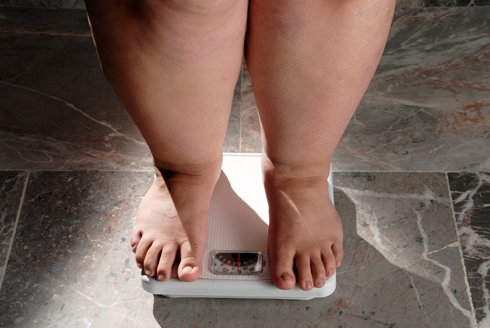Global Obesity Crisis: Over a Billion People Affected as Health Experts Sound the Alarm