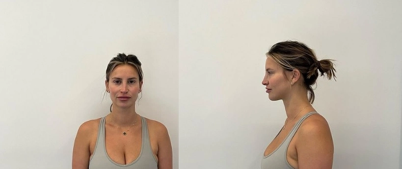 Ferne McCann earns praise for sharing authentic postpartum body photos