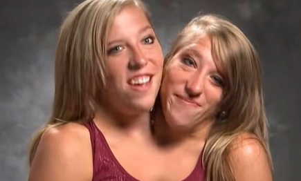 She Said Yes: Conjoined Twin Abby Hensel Gets Married