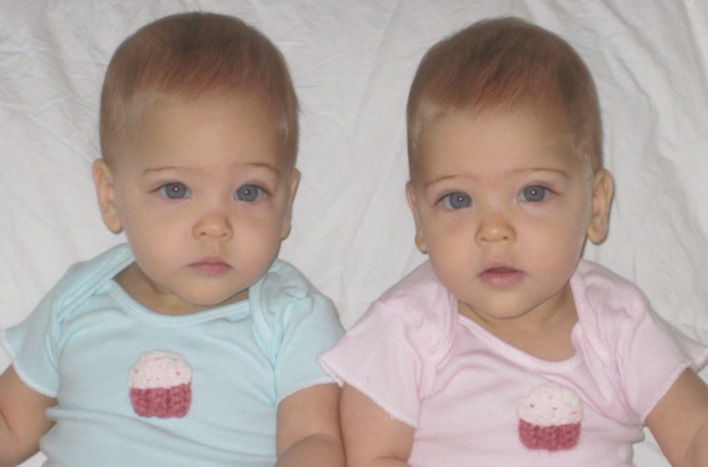 They Were Dubbed ‘World’s Most Beautiful Twins’ 13 Years Ago: Here’s What They Look Like Today