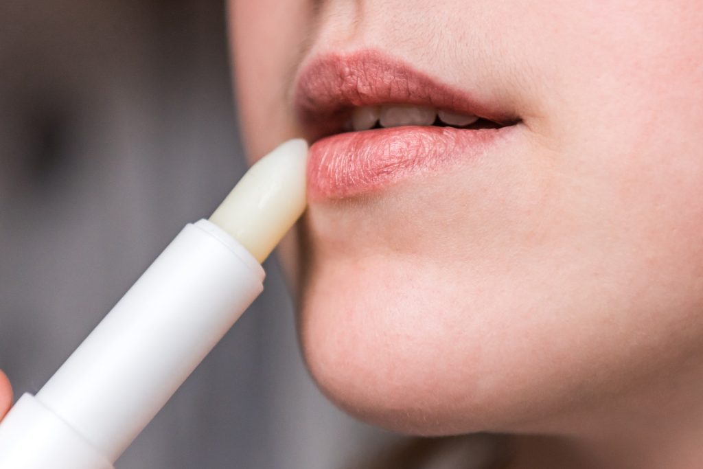 How to Prevent and Treat Dry Lips