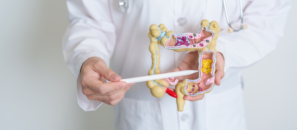 Colon Polyps: 7 Symptoms You Need to Know to Prevent Cancer