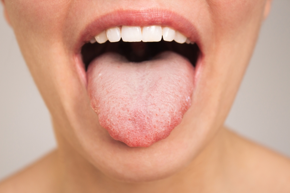 Your Mouth Tells a Story About Your Health