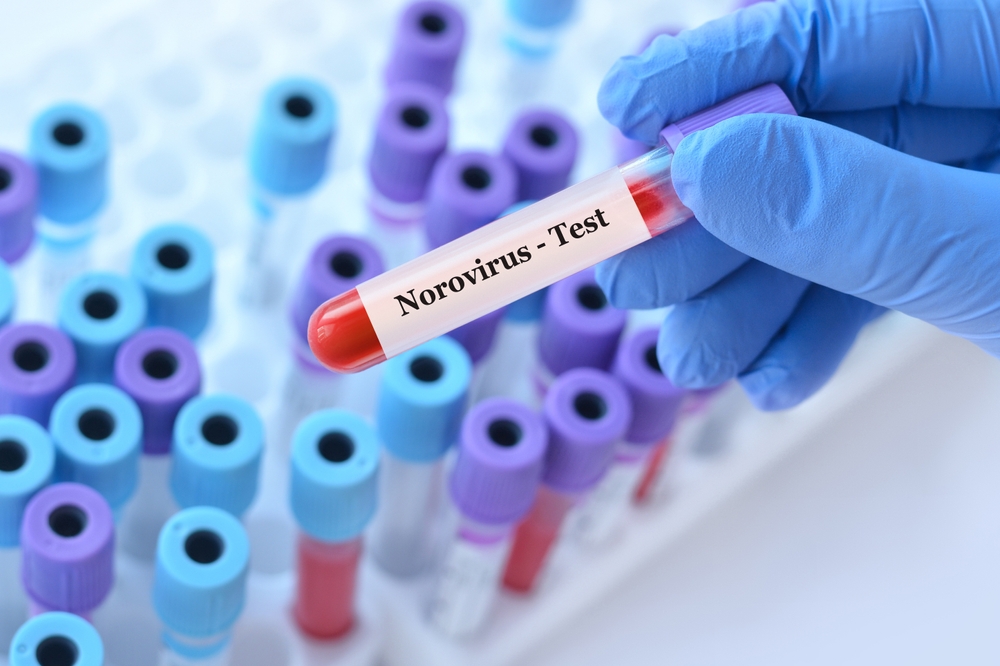 Stomach Virus Cases Surge Across the U.S.