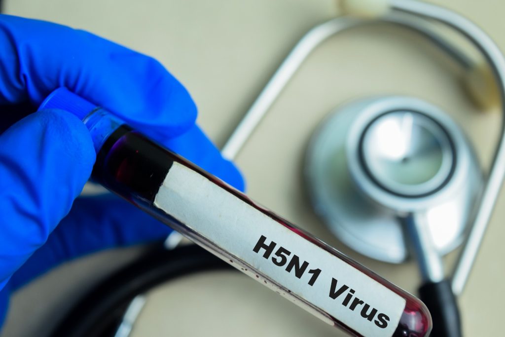 U.S. Reports First Death from Bird Flu