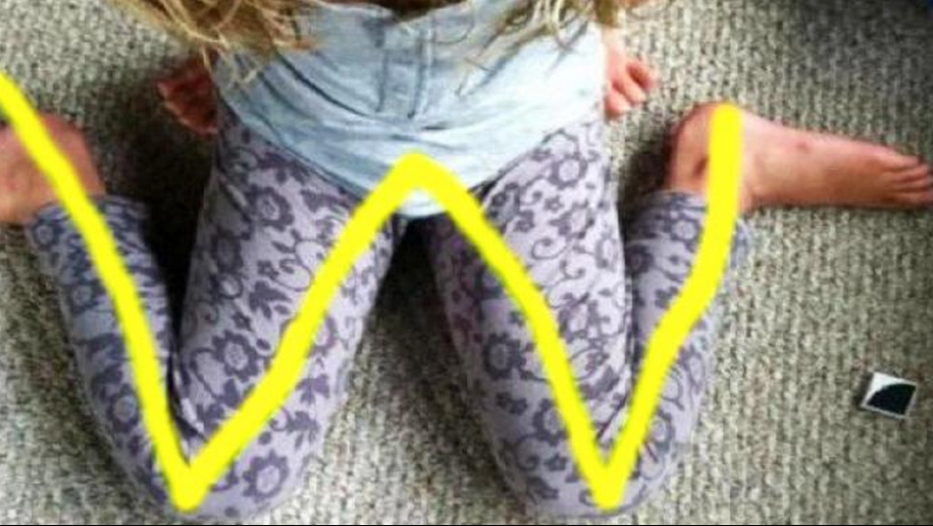 If you see children doing this with their legs, stop them immediately