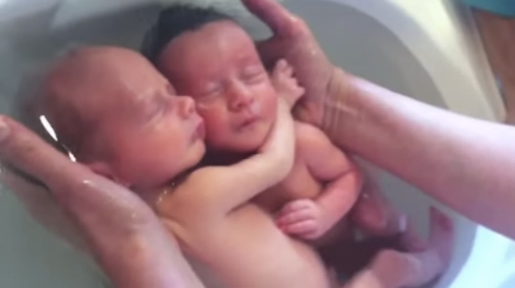 Watch the amazing video: Twins haven’t realized they’ve been born