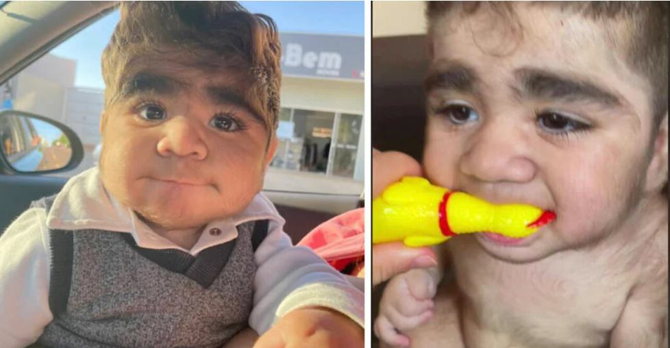 Baby with unusual amount of hair looks like a grown man: Social media in awe