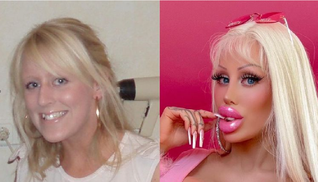 Woman spends over $130,000 to transform into a human Barbie
