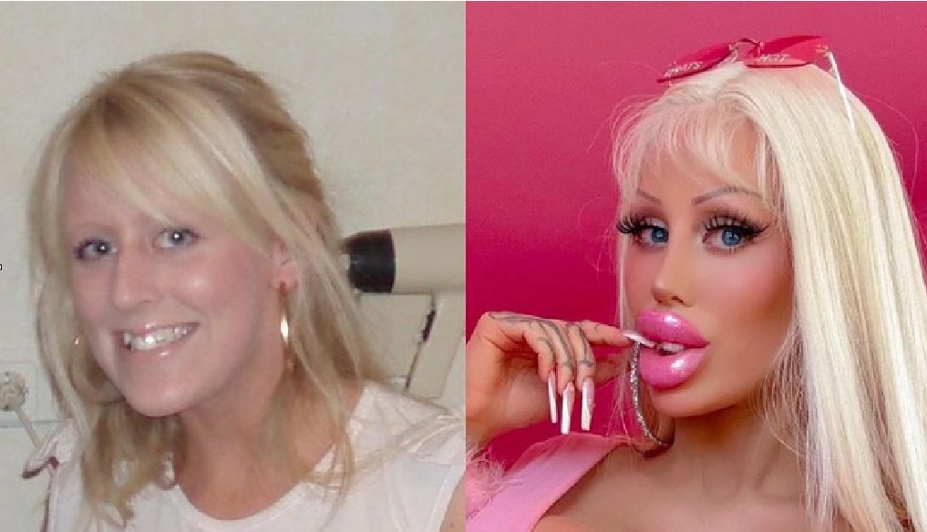 Woman spends over $130,000 to transform into a human Barbie