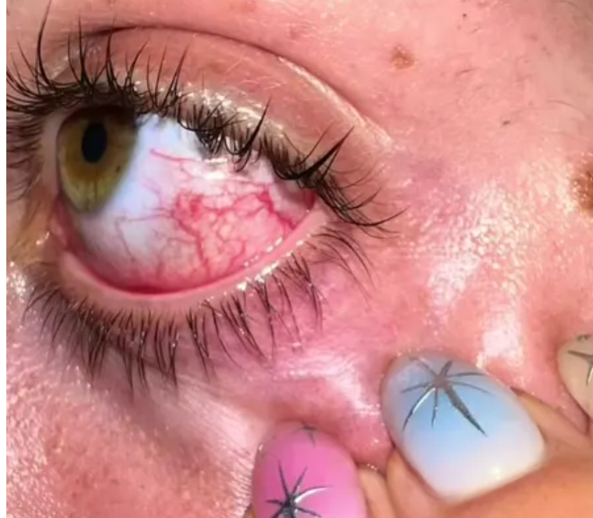 Watch TikTok star get attacked by magpie – She fears eye injury