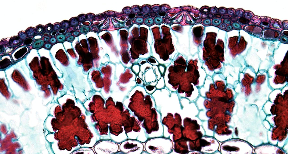 Breakthrough in Cancer Research: We Now Know How Cancer Cells Spread