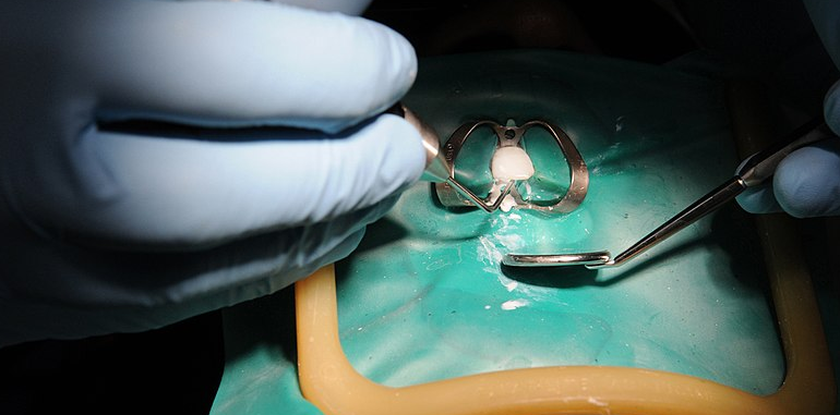 Heartbreak at the Hospital: Young Child’s Life Claimed During Dental Procedure