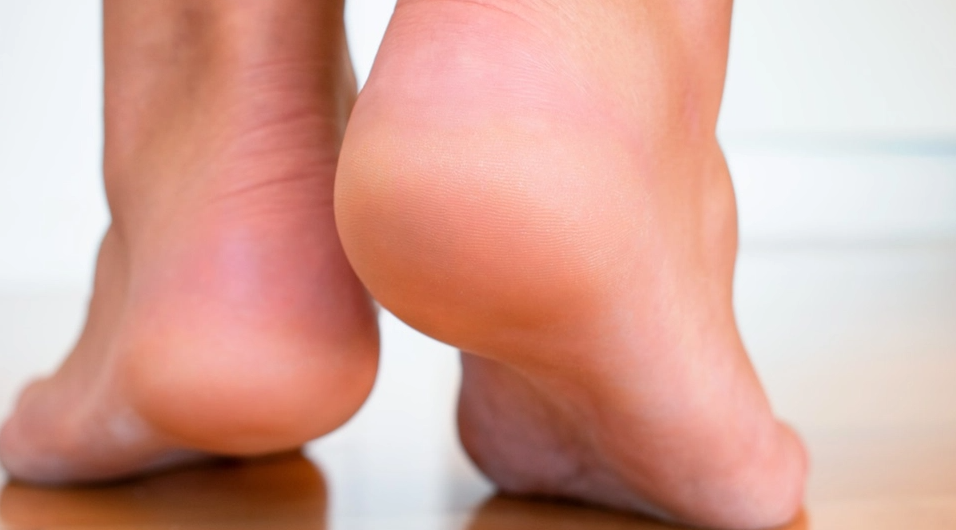 Five Main Reasons for Cracked Heels