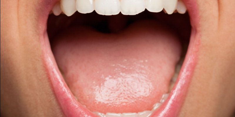 7 Signs of Diabetes That Show Up in the Mouth and How to Detect the Disease